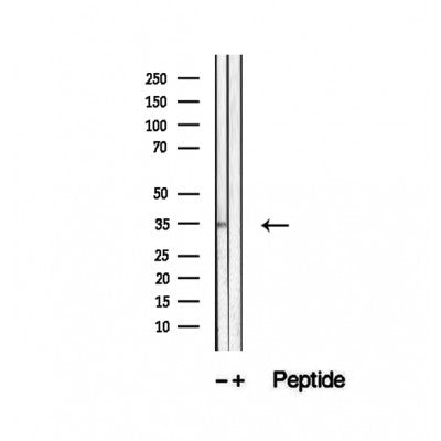 DF12494 staining Hela by IF/ICC. The sample were fixed with PFA and permeabilized in 0.1% Triton X-100,then blocked in 10% serum for 45 minutes at 25¡ãC. The primary antibody was diluted at 1/200 and incubated with the sample for 1 hour at 37¡ãC. An  Alexa Fluor 594 conjugated goat anti-rabbit IgG (H+L) Ab, diluted at 1/600, was used as the secondary antibod