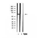 Western blot analysis of extracts from Rat kidney, using uPAR Antibody. The lane on the left was treated with blocking peptide.