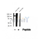 DF12497 at 1/100 staining Human thyroid cancer tissue by IHC-P. The sample was formaldehyde fixed and a heat mediated antigen retrieval step in citrate buffer was performed. The sample was then blocked and incubated with the antibody for 1.5 hours at 22¡ãC. An HRP conjugated goat anti-rabbit antibody was used as the secondary