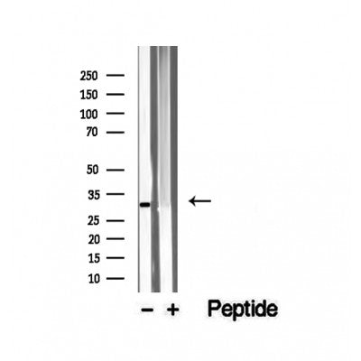 DF12499 staining Hela by IF/ICC. The sample were fixed with PFA and permeabilized in 0.1% Triton X-100,then blocked in 10% serum for 45 minutes at 25¡ãC. The primary antibody was diluted at 1/200 and incubated with the sample for 1 hour at 37¡ãC. An  Alexa Fluor 594 conjugated goat anti-rabbit IgG (H+L) Ab, diluted at 1/600, was used as the secondary antibod