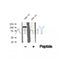 DF12500 at 1/100 staining Human thyroid cancer tissue by IHC-P. The sample was formaldehyde fixed and a heat mediated antigen retrieval step in citrate buffer was performed. The sample was then blocked and incubated with the antibody for 1.5 hours at 22¡ãC. An HRP conjugated goat anti-rabbit antibody was used as the secondary