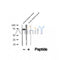 DF12501 at 1/100 staining Human thyroid cancer tissue by IHC-P. The sample was formaldehyde fixed and a heat mediated antigen retrieval step in citrate buffer was performed. The sample was then blocked and incubated with the antibody for 1.5 hours at 22¡ãC. An HRP conjugated goat anti-rabbit antibody was used as the secondary