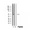 DF12502 staining Hela by IF/ICC. The sample were fixed with PFA and permeabilized in 0.1% Triton X-100,then blocked in 10% serum for 45 minutes at 25¡ãC. The primary antibody was diluted at 1/200 and incubated with the sample for 1 hour at 37¡ãC. An  Alexa Fluor 594 conjugated goat anti-rabbit IgG (H+L) Ab, diluted at 1/600, was used as the secondary antibod