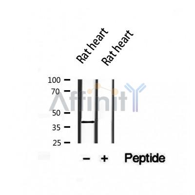 DF12503 at 1/100 staining Human pancreas tissue by IHC-P. The sample was formaldehyde fixed and a heat mediated antigen retrieval step in citrate buffer was performed. The sample was then blocked and incubated with the antibody for 1.5 hours at 22¡ãC. An HRP conjugated goat anti-rabbit antibody was used as the secondary