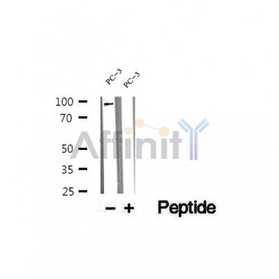 DF12506 at 1/100 staining Mouse liver tissue by IHC-P. The sample was formaldehyde fixed and a heat mediated antigen retrieval step in citrate buffer was performed. The sample was then blocked and incubated with the antibody for 1.5 hours at 22¡ãC. An HRP conjugated goat anti-rabbit antibody was used as the secondary