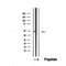 DF12508 at 1/100 staining Human thyroid cancer tissue by IHC-P. The sample was formaldehyde fixed and a heat mediated antigen retrieval step in citrate buffer was performed. The sample was then blocked and incubated with the antibody for 1.5 hours at 22¡ãC. An HRP conjugated goat anti-rabbit antibody was used as the secondary