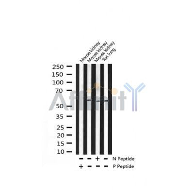 Western blot analysis of extracts from Mouse brain, using Phospho-MEF2A (Thr319) Antibody. Lane 1 was treated with the blocking peptide.