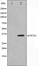 Western blot analysis on HepG2 cell lysate using PCNA Antibody,The lane on the left is treated with the antigen-specific peptide.