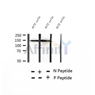 AF2301 at 1/100 staining Human thyroid cancer tissue by IHC-P. The sample was formaldehyde fixed and a heat mediated antigen retrieval step in citrate buffer was performed. The sample was then blocked and incubated with the antibody for 1.5 hours at 22¡ãC. An HRP conjugated goat anti-rabbit antibody was used as the secondary