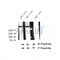 AF2303 at 1/100 staining Human thyroid cancer tissue by IHC-P. The sample was formaldehyde fixed and a heat mediated antigen retrieval step in citrate buffer was performed. The sample was then blocked and incubated with the antibody for 1.5 hours at 22¡ãC. An HRP conjugated goat anti-rabbit antibody was used as the secondary