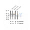 AF2306 at 1/100 staining Human thyroid cancer tissue by IHC-P. The sample was formaldehyde fixed and a heat mediated antigen retrieval step in citrate buffer was performed. The sample was then blocked and incubated with the antibody for 1.5 hours at 22¡ãC. An HRP conjugated goat anti-rabbit antibody was used as the secondary