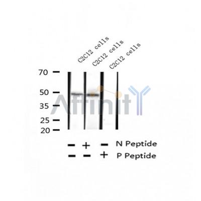 AF2306 at 1/100 staining Human thyroid cancer tissue by IHC-P. The sample was formaldehyde fixed and a heat mediated antigen retrieval step in citrate buffer was performed. The sample was then blocked and incubated with the antibody for 1.5 hours at 22¡ãC. An HRP conjugated goat anti-rabbit antibody was used as the secondary