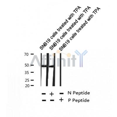 AF2307 at 1/100 staining Human thyroid cancer tissue by IHC-P. The sample was formaldehyde fixed and a heat mediated antigen retrieval step in citrate buffer was performed. The sample was then blocked and incubated with the antibody for 1.5 hours at 22¡ãC. An HRP conjugated goat anti-rabbit antibody was used as the secondary