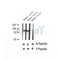 AF2309 at 1/100 staining Human thyroid cancer tissue by IHC-P. The sample was formaldehyde fixed and a heat mediated antigen retrieval step in citrate buffer was performed. The sample was then blocked and incubated with the antibody for 1.5 hours at 22¡ãC. An HRP conjugated goat anti-rabbit antibody was used as the secondary