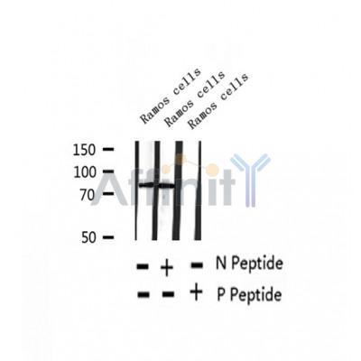 AF2309 at 1/100 staining Human thyroid cancer tissue by IHC-P. The sample was formaldehyde fixed and a heat mediated antigen retrieval step in citrate buffer was performed. The sample was then blocked and incubated with the antibody for 1.5 hours at 22¡ãC. An HRP conjugated goat anti-rabbit antibody was used as the secondary