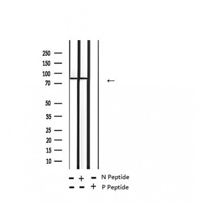 AF2310 at 1/100 staining Rat brain tissue by IHC-P. The sample was formaldehyde fixed and a heat mediated antigen retrieval step in citrate buffer was performed. The sample was then blocked and incubated with the antibody for 1.5 hours at 22¡ãC. An HRP conjugated goat anti-rabbit antibody was used as the secondary