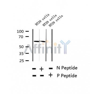 AF2314 at 1/100 staining Human thyroid cancer tissue by IHC-P. The sample was formaldehyde fixed and a heat mediated antigen retrieval step in citrate buffer was performed. The sample was then blocked and incubated with the antibody for 1.5 hours at 22¡ãC. An HRP conjugated goat anti-rabbit antibody was used as the secondary