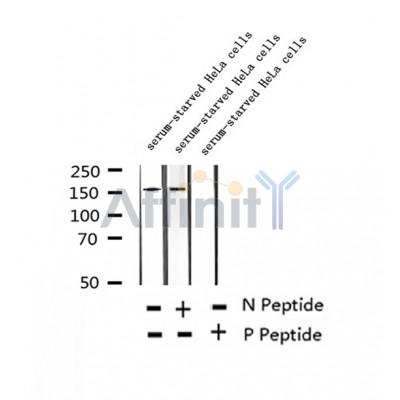 AF2317 at 1/100 staining Human thyroid cancer tissue by IHC-P. The sample was formaldehyde fixed and a heat mediated antigen retrieval step in citrate buffer was performed. The sample was then blocked and incubated with the antibody for 1.5 hours at 22¡ãC. An HRP conjugated goat anti-rabbit antibody was used as the secondary