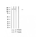 AF2318 at 1/100 staining Human thyroid cancer tissue by IHC-P. The sample was formaldehyde fixed and a heat mediated antigen retrieval step in citrate buffer was performed. The sample was then blocked and incubated with the antibody for 1.5 hours at 22¡ãC. An HRP conjugated goat anti-rabbit antibody was used as the secondary