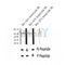 AF2324 at 1/100 staining Human thyroid cancer tissue by IHC-P. The sample was formaldehyde fixed and a heat mediated antigen retrieval step in citrate buffer was performed. The sample was then blocked and incubated with the antibody for 1.5 hours at 22¡ãC. An HRP conjugated goat anti-rabbit antibody was used as the secondary