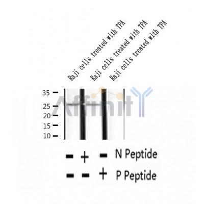 AF2324 at 1/100 staining Human thyroid cancer tissue by IHC-P. The sample was formaldehyde fixed and a heat mediated antigen retrieval step in citrate buffer was performed. The sample was then blocked and incubated with the antibody for 1.5 hours at 22¡ãC. An HRP conjugated goat anti-rabbit antibody was used as the secondary