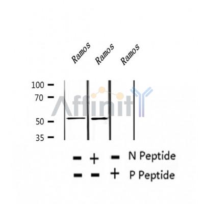 AF2329 at 1/100 staining Human thyroid cancer tissue by IHC-P. The sample was formaldehyde fixed and a heat mediated antigen retrieval step in citrate buffer was performed. The sample was then blocked and incubated with the antibody for 1.5 hours at 22¡ãC. An HRP conjugated goat anti-rabbit antibody was used as the secondary