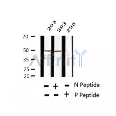 AF2334 at 1/100 staining Human gastric tissue by IHC-P. The sample was formaldehyde fixed and a heat mediated antigen retrieval step in citrate buffer was performed. The sample was then blocked and incubated with the antibody for 1.5 hours at 22¡ãC. An HRP conjugated goat anti-rabbit antibody was used as the secondary