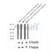 AF2336 at 1/100 staining Human thyroid cancer tissue by IHC-P. The sample was formaldehyde fixed and a heat mediated antigen retrieval step in citrate buffer was performed. The sample was then blocked and incubated with the antibody for 1.5 hours at 22¡ãC. An HRP conjugated goat anti-rabbit antibody was used as the secondary