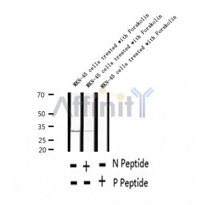 AF2336 at 1/100 staining Human thyroid cancer tissue by IHC-P. The sample was formaldehyde fixed and a heat mediated antigen retrieval step in citrate buffer was performed. The sample was then blocked and incubated with the antibody for 1.5 hours at 22¡ãC. An HRP conjugated goat anti-rabbit antibody was used as the secondary