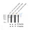AF2337 at 1/100 staining Human breast cancer tissue by IHC-P. The sample was formaldehyde fixed and a heat mediated antigen retrieval step in citrate buffer was performed. The sample was then blocked and incubated with the antibody for 1.5 hours at 22¡ãC. An HRP conjugated goat anti-rabbit antibody was used as the secondary