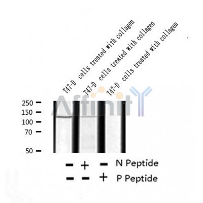 AF2337 at 1/100 staining Human breast cancer tissue by IHC-P. The sample was formaldehyde fixed and a heat mediated antigen retrieval step in citrate buffer was performed. The sample was then blocked and incubated with the antibody for 1.5 hours at 22¡ãC. An HRP conjugated goat anti-rabbit antibody was used as the secondary