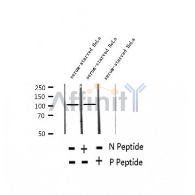 AF2340 at 1/100 staining Human thyroid cancer tissue by IHC-P. The sample was formaldehyde fixed and a heat mediated antigen retrieval step in citrate buffer was performed. The sample was then blocked and incubated with the antibody for 1.5 hours at 22¡ãC. An HRP conjugated goat anti-rabbit antibody was used as the secondary