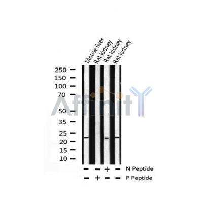 AF3386 staining HuvEc cells by IF/ICC. The sample were fixed with PFA and permeabilized in 0.1% Triton X-100,then blocked in 10% serum for 45 minutes at 25¡ãC. The primary antibody was diluted at 1/200 and incubated with the sample for 1 hour at 37¡ãC. An  Alexa Fluor 594 conjugated goat anti-rabbit IgG (H+L) antibody(Cat.