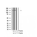 AF2342 at 1/100 staining Human thyroid cancer tissue by IHC-P. The sample was formaldehyde fixed and a heat mediated antigen retrieval step in citrate buffer was performed. The sample was then blocked and incubated with the antibody for 1.5 hours at 22¡ãC. An HRP conjugated goat anti-rabbit antibody was used as the secondary