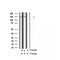 AF2342 at 1/100 staining Human thyroid cancer tissue by IHC-P. The sample was formaldehyde fixed and a heat mediated antigen retrieval step in citrate buffer was performed. The sample was then blocked and incubated with the antibody for 1.5 hours at 22¡ãC. An HRP conjugated goat anti-rabbit antibody was used as the secondary