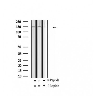 AF2342 at 1/100 staining Human thyroid cancer tissue by IHC-P. The sample was formaldehyde fixed and a heat mediated antigen retrieval step in citrate buffer was performed. The sample was then blocked and incubated with the antibody for 1.5 hours at 22¡ãC. An HRP conjugated goat anti-rabbit antibody was used as the secondary