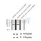 AF2343 at 1/100 staining Human breast cancer tissue by IHC-P. The sample was formaldehyde fixed and a heat mediated antigen retrieval step in citrate buffer was performed. The sample was then blocked and incubated with the antibody for 1.5 hours at 22¡ãC. An HRP conjugated goat anti-rabbit antibody was used as the secondary