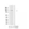 AF2345 at 1/100 staining Human thyroid cancer tissue by IHC-P. The sample was formaldehyde fixed and a heat mediated antigen retrieval step in citrate buffer was performed. The sample was then blocked and incubated with the antibody for 1.5 hours at 22¡ãC. An HRP conjugated goat anti-rabbit antibody was used as the secondary