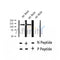 AF2346 at 1/100 staining Human thyroid cancer tissue by IHC-P. The sample was formaldehyde fixed and a heat mediated antigen retrieval step in citrate buffer was performed. The sample was then blocked and incubated with the antibody for 1.5 hours at 22¡ãC. An HRP conjugated goat anti-rabbit antibody was used as the secondary