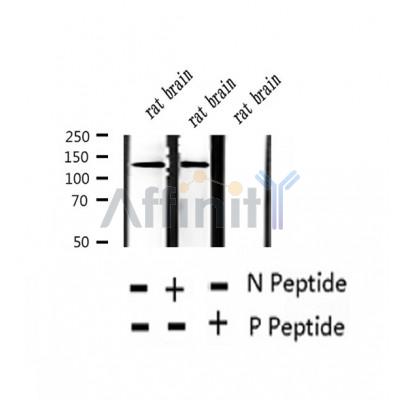 AF2346 at 1/100 staining Human thyroid cancer tissue by IHC-P. The sample was formaldehyde fixed and a heat mediated antigen retrieval step in citrate buffer was performed. The sample was then blocked and incubated with the antibody for 1.5 hours at 22¡ãC. An HRP conjugated goat anti-rabbit antibody was used as the secondary