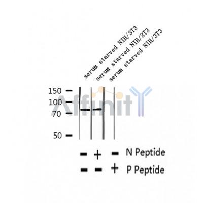 AF2347 at 1/100 staining Human thyroid cancer tissue by IHC-P. The sample was formaldehyde fixed and a heat mediated antigen retrieval step in citrate buffer was performed. The sample was then blocked and incubated with the antibody for 1.5 hours at 22¡ãC. An HRP conjugated goat anti-rabbit antibody was used as the secondary