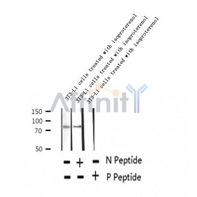 AF2350 at 1/100 staining Human thyroid cancer tissue by IHC-P. The sample was formaldehyde fixed and a heat mediated antigen retrieval step in citrate buffer was performed. The sample was then blocked and incubated with the antibody for 1.5 hours at 22¡ãC. An HRP conjugated goat anti-rabbit antibody was used as the secondary