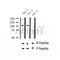 AF2352 at 1/100 staining Human thyroid cancer tissue by IHC-P. The sample was formaldehyde fixed and a heat mediated antigen retrieval step in citrate buffer was performed. The sample was then blocked and incubated with the antibody for 1.5 hours at 22¡ãC. An HRP conjugated goat anti-rabbit antibody was used as the secondary
