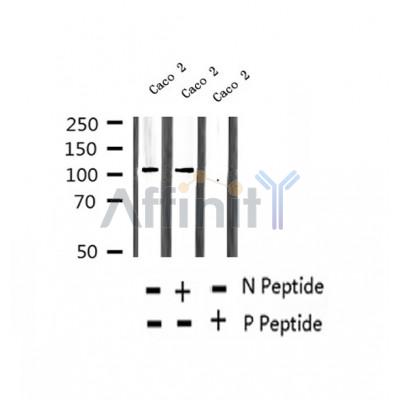 AF2352 at 1/100 staining Human thyroid cancer tissue by IHC-P. The sample was formaldehyde fixed and a heat mediated antigen retrieval step in citrate buffer was performed. The sample was then blocked and incubated with the antibody for 1.5 hours at 22¡ãC. An HRP conjugated goat anti-rabbit antibody was used as the secondary