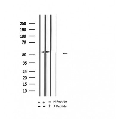 AF2353 at 1/100 staining Human lung tissue by IHC-P. The sample was formaldehyde fixed and a heat mediated antigen retrieval step in citrate buffer was performed. The sample was then blocked and incubated with the antibody for 1.5 hours at 22¡ãC. An HRP conjugated goat anti-rabbit antibody was used as the secondary