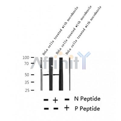AF2355 at 1/100 staining Human colon cancer tissue by IHC-P. The sample was formaldehyde fixed and a heat mediated antigen retrieval step in citrate buffer was performed. The sample was then blocked and incubated with the antibody for 1.5 hours at 22¡ãC. An HRP conjugated goat anti-rabbit antibody was used as the secondary