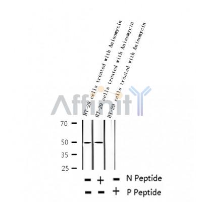 AF2356 at 1/100 staining Human thyroid cancer tissue by IHC-P. The sample was formaldehyde fixed and a heat mediated antigen retrieval step in citrate buffer was performed. The sample was then blocked and incubated with the antibody for 1.5 hours at 22¡ãC. An HRP conjugated goat anti-rabbit antibody was used as the secondary