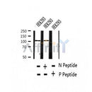 AF2358 at 1/100 staining Human thyroid cancer tissue by IHC-P. The sample was formaldehyde fixed and a heat mediated antigen retrieval step in citrate buffer was performed. The sample was then blocked and incubated with the antibody for 1.5 hours at 22¡ãC. An HRP conjugated goat anti-rabbit antibody was used as the secondary
