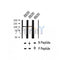 AF2358 at 1/100 staining Human thyroid cancer tissue by IHC-P. The sample was formaldehyde fixed and a heat mediated antigen retrieval step in citrate buffer was performed. The sample was then blocked and incubated with the antibody for 1.5 hours at 22¡ãC. An HRP conjugated goat anti-rabbit antibody was used as the secondary