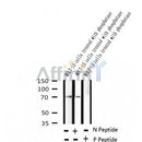 AF2360 at 1/100 staining Human thyroid cancer tissue by IHC-P. The sample was formaldehyde fixed and a heat mediated antigen retrieval step in citrate buffer was performed. The sample was then blocked and incubated with the antibody for 1.5 hours at 22¡ãC. An HRP conjugated goat anti-rabbit antibody was used as the secondary